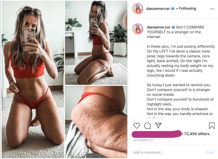 How Social Media's Portrayal of Body Positivity Can Do More Harm